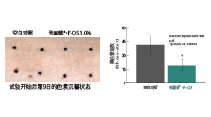 倍麗蘇??F-QS(圖4)